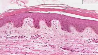 Shotgun Histology Thin Skin [upl. by Leena]