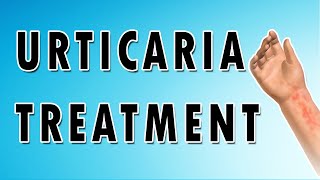 Urticaria Symptoms Treatment and Causes [upl. by Ellinad]