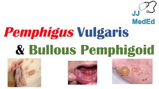 Vesiculobullous Skin Diseases  Pemphigus Vulgaris vs Bullous Pemphigoid [upl. by Sakul]