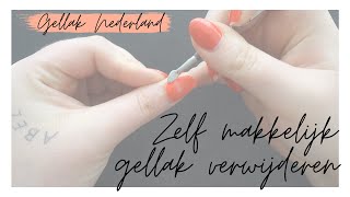 GELLAK VERWIJDEREN  Uitgebreide uitleg  Gellak Nederland [upl. by Aneeres]