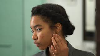 How to treat acne in skin of color [upl. by Jobe]