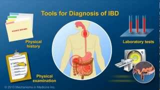 Diagnosing IBD [upl. by Giff]