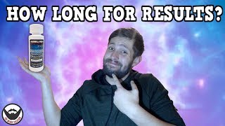 quotHow Long Before I See Resultsquot  Minoxidil Beards  BeardTalk  Ep 4 [upl. by Maher545]