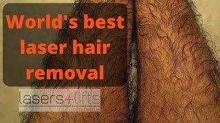 Worlds best hair removal laser [upl. by Celesta]