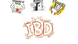 Inflammatory Bowel Disease IBD [upl. by Marilyn]