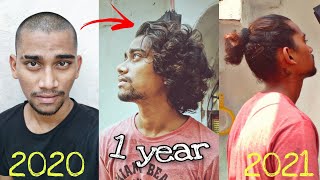 Hair Growth Timelapse  1 Year [upl. by Spiegel]