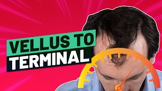 Vellus Hair to Terminal Hair  How to Speed It Up [upl. by Yesnyl682]