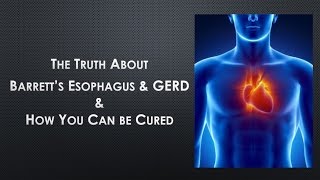 How To Cure Barretts Esophagus  The Truth About Barretts Esophagus [upl. by Krall]