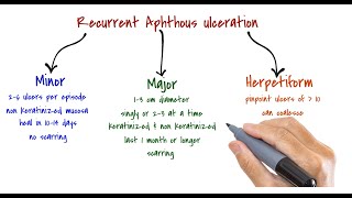 ORAL MEDICINE  Recurrent Aphthous Ulceration [upl. by Ailyt293]