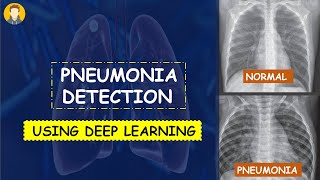 PNEUMONIA Detection Using Deep Learning in Tensorflow Keras amp Python  KNOWLEDGE DOCTOR [upl. by Warfeld237]