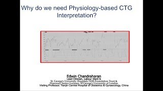 Why do we need Physiologybased CTG Interpretation [upl. by Petie]